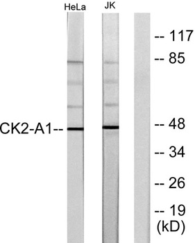 Casein Kinase IIα rabbit pAb