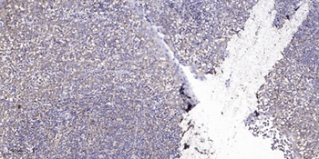 Casein Kinase IIα rabbit pAb