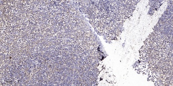 Casein Kinase IIalpha antibody