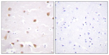 Casein Kinase IIbeta antibody