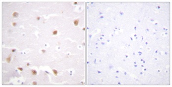 Casein Kinase IIβ rabbit pAb