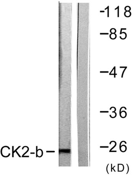 Casein Kinase IIβ rabbit pAb