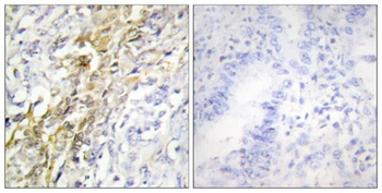 Casein Kinase Iα rabbit pAb