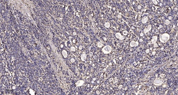Casein Kinase Iγ1 rabbit pAb