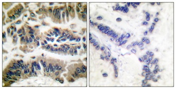 Caspase-6 rabbit pAb Antibody