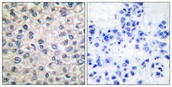 Catenin-α E/N rabbit pAb