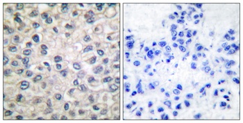 Catenin-alpha E/N antibody