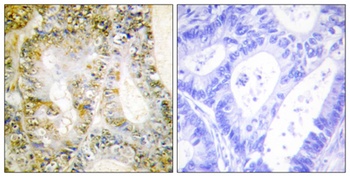 Catenin-β1 rabbit pAb