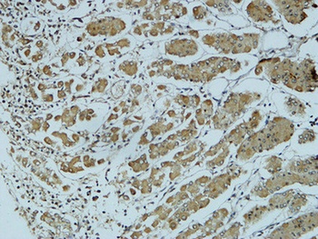 Cathepsin B rabbit pAb