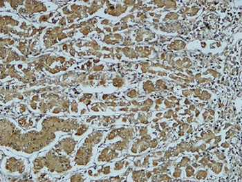Cathepsin B rabbit pAb