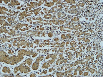 Cathepsin B antibody