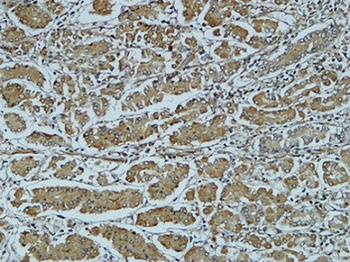 Cathepsin B rabbit pAb