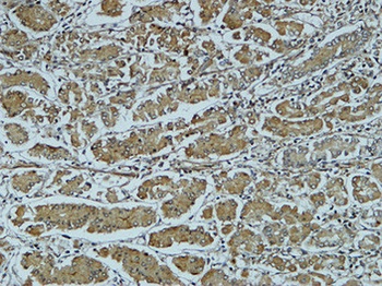 Cathepsin B antibody