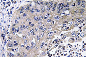 Cathepsin D rabbit pAb
