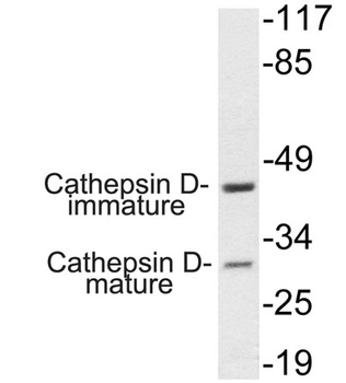 Cathepsin D rabbit pAb