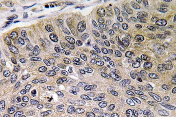 Cathepsin E rabbit pAb