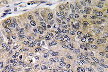 Cathepsin E antibody