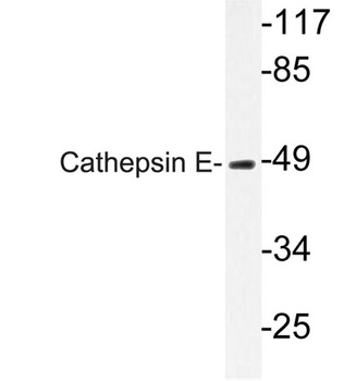 Cathepsin E antibody