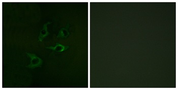 Cbl rabbit pAb