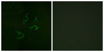 Cbl antibody