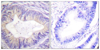 Cbl antibody