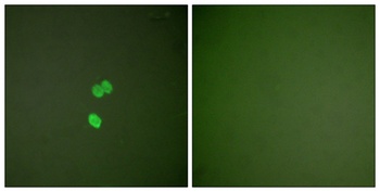 Galectin 3 antibody