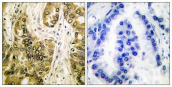 Galectin 3 antibody