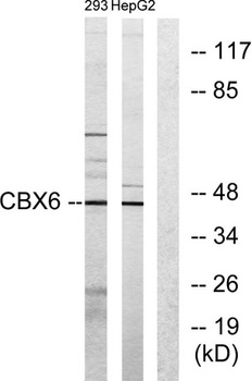 CBX6 rabbit pAb