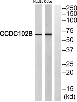 CCDC102B rabbit pAb Antibody
