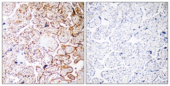 CCDC102B rabbit pAb Antibody