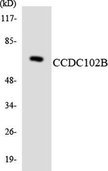 CCDC102B rabbit pAb Antibody