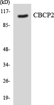 CCP2 antibody