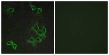 CCRL1 rabbit pAb