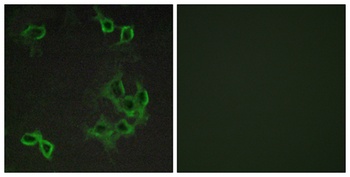 CCRL1 antibody