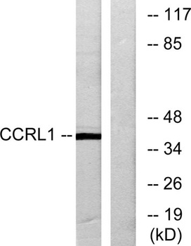 CCRL1 rabbit pAb