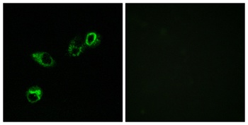 CCRL1 rabbit pAb