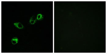 CCRL1 antibody