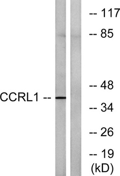 CCRL1 rabbit pAb