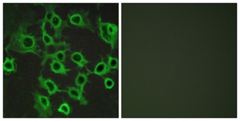 CCRL2 rabbit pAb