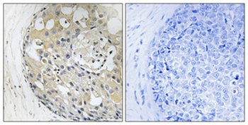 CD2BP2 rabbit pAb