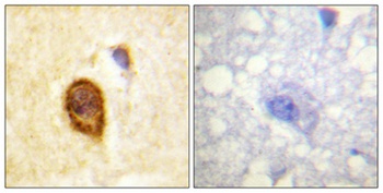 CD4 antibody