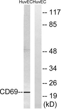 CD69 rabbit pAb