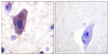 CD71 antibody