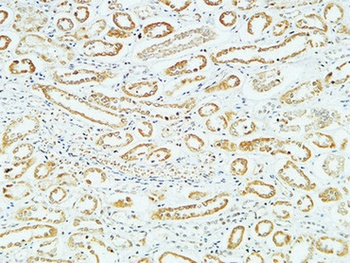 CD83 rabbit pAb