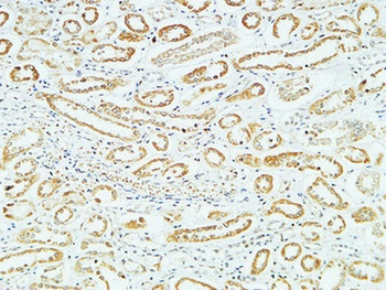 CD83 antibody