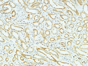 CD83 rabbit pAb
