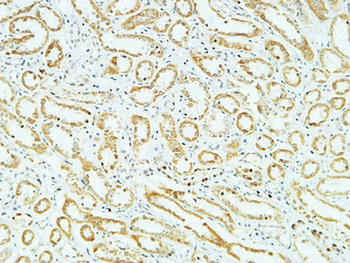 CD83 antibody