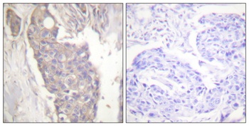 CD95 antibody