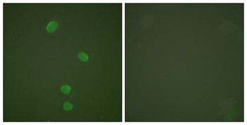 CDC46 antibody