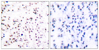CDC46 rabbit pAb